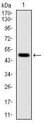 Anti-TUBA8 Antibody (8N451)