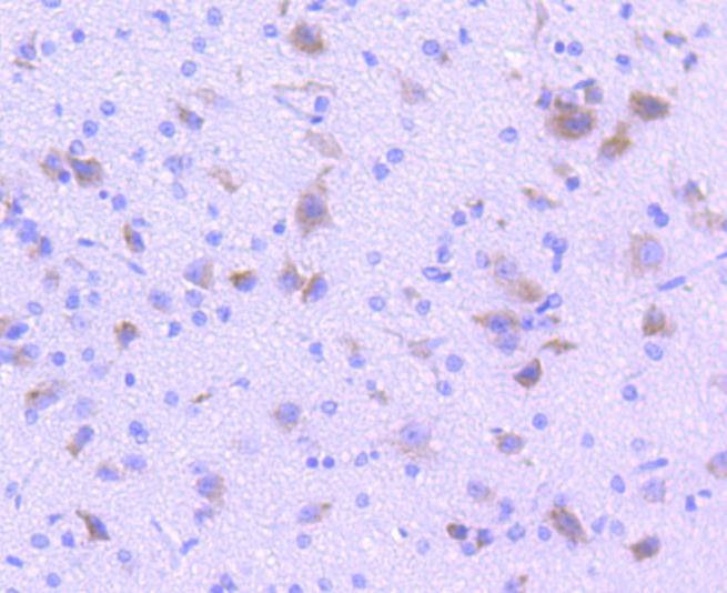 Anti-Tryptophan Hydroxylase 1/TPH-1 Antibody (9H209)