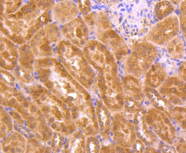 Anti-TSG101 Antibody (9U262)
