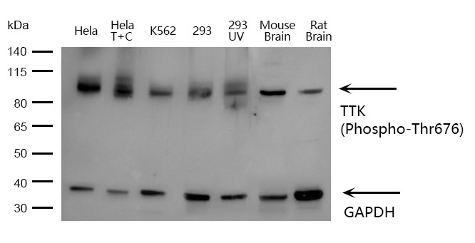 Anti-Phospho-TTK (Thr676) Polyclonal Antibody