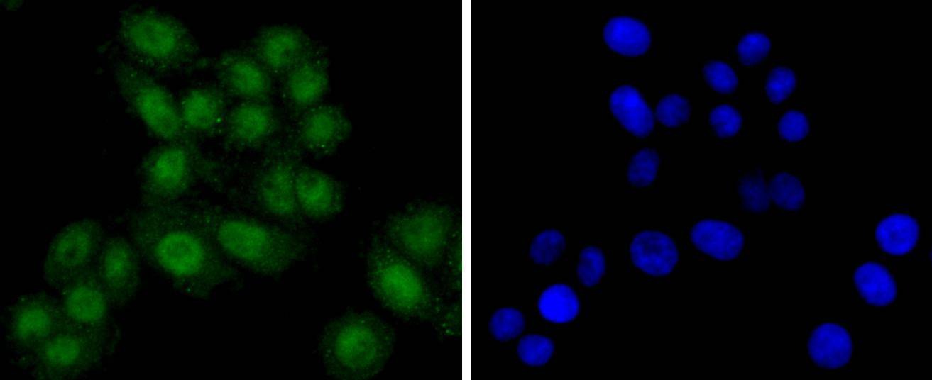 Anti-TSG101 Antibody (9U262)