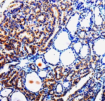Anti-TUBB3 Polyclonal Antibody 3