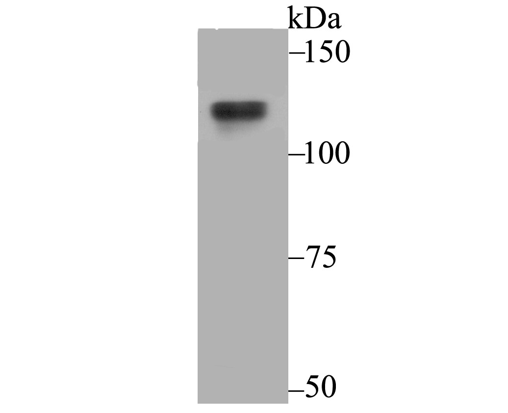 Anti-USP7 Antibody (8N914)