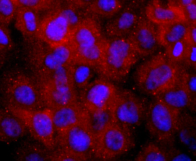 Anti-Chorionic Gonadotropin/CGA Antibody (5Q170)