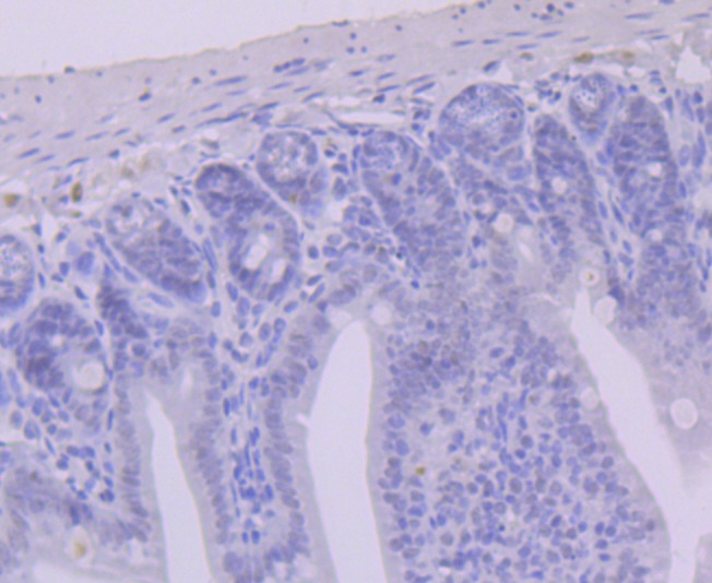Anti-USP7 Antibody (8N914)