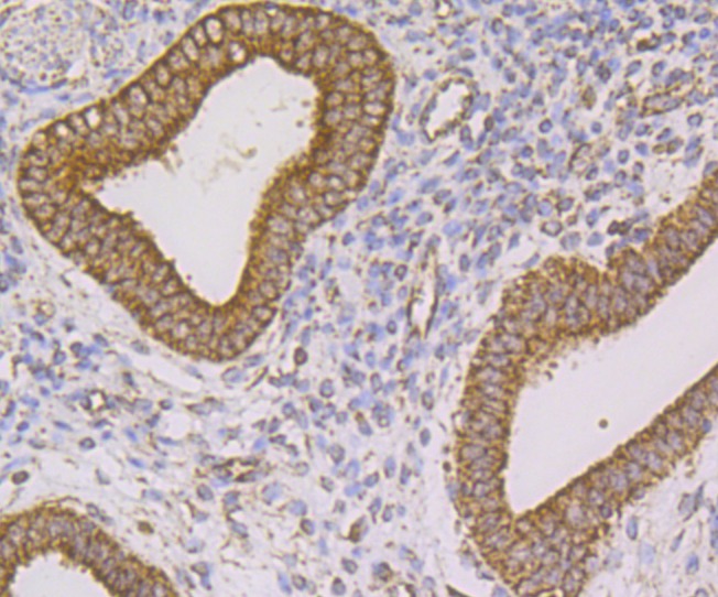 Anti-FIS1 Antibody (5I637)