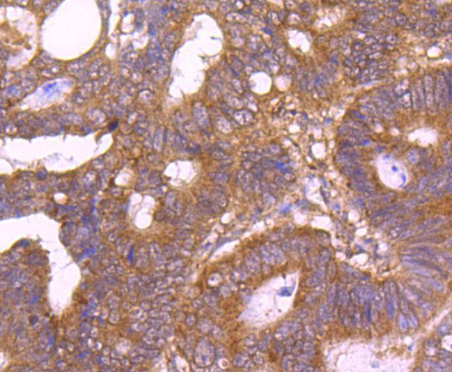 Anti-TSG101 Antibody (9U262)