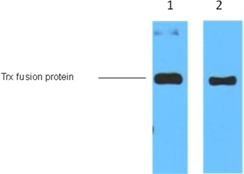 Anti-Trx Tag Antibody (2R216)