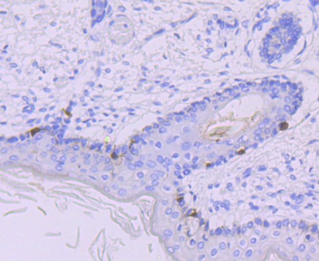 Anti-TRP1 Antibody (9T409)