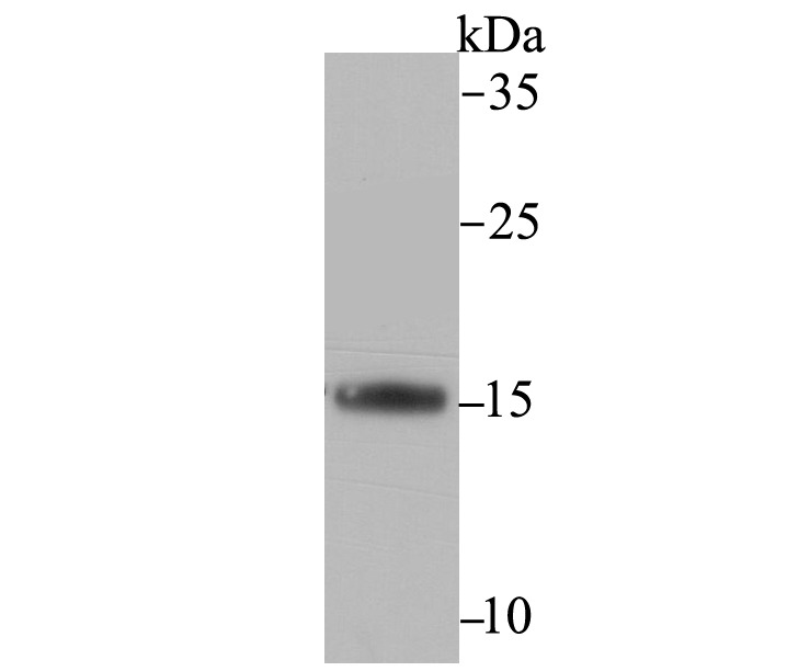Anti-FIS1 Antibody (5I637)