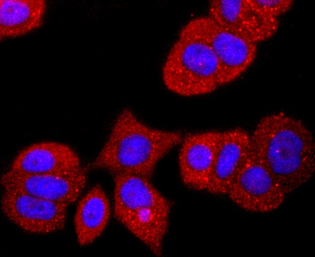 Anti-Transthyretin Antibody (5H602)