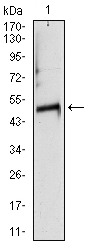 Anti-TUBA8 Antibody (8N451)