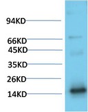 Anti-Transthyretin Antibody (3O334)