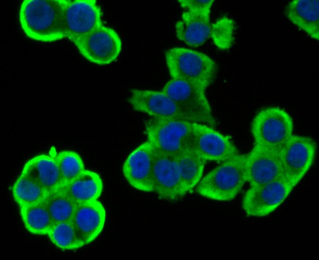 Anti-Wnt2b Antibody (5C251)