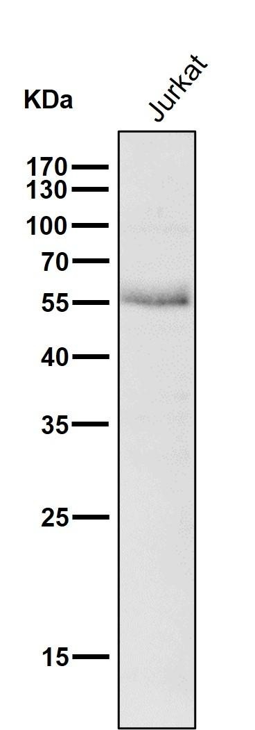 Anti-Wilms tumor/WT1 Antibody (8L145)