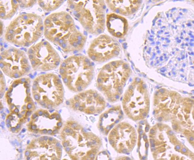 Anti-Zyxin Antibody (5W666)