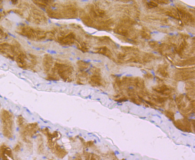 Anti-Zyxin Antibody (5W666)