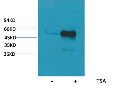 Anti-Acetyl-α-tubulin (Lys40) Antibody (4A610)