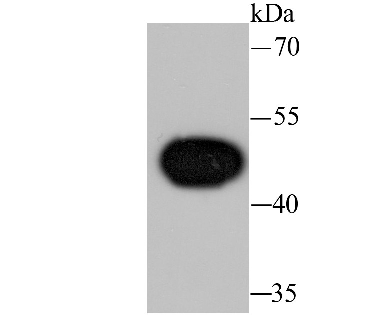 Anti-Wnt5a Antibody (2Q540)