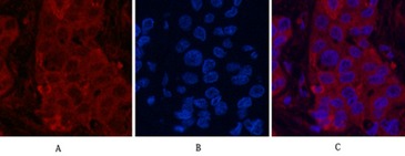 Anti-Acetyl-α-tubulin (Lys40) Antibody (6I106)