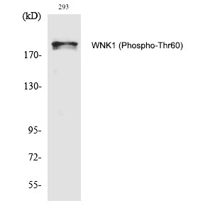 Anti-Phospho-WNK1 (Thr60) Polyclonal Antibody