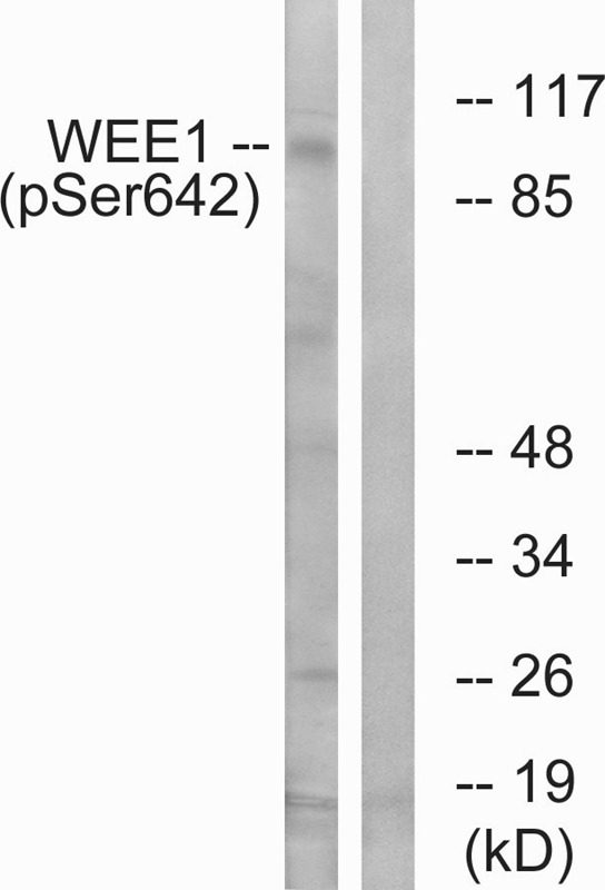 Anti-Phospho-Wee 1 (Ser642) Polyclonal Antibody