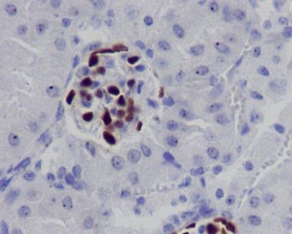 Anti-Wilms tumor/WT1 Antibody (8L145)