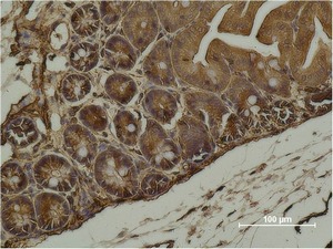 Anti-ACTA2 Antibody (2K214)