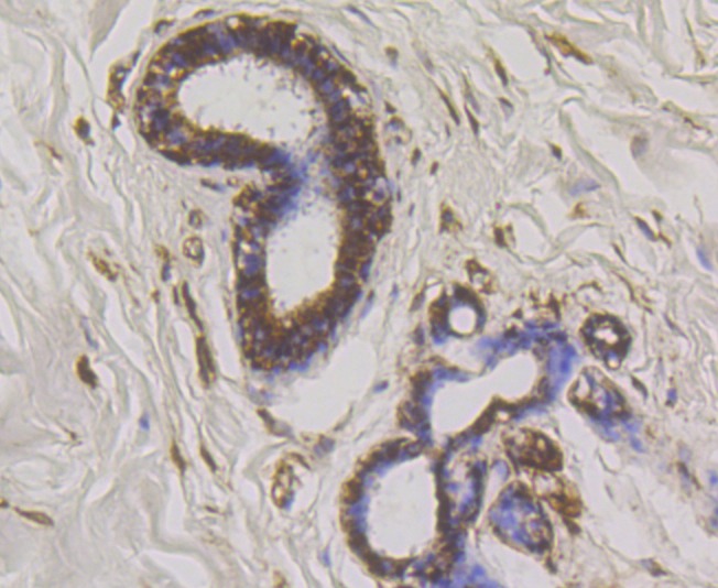 Anti-WNK1 Antibody (1S306)