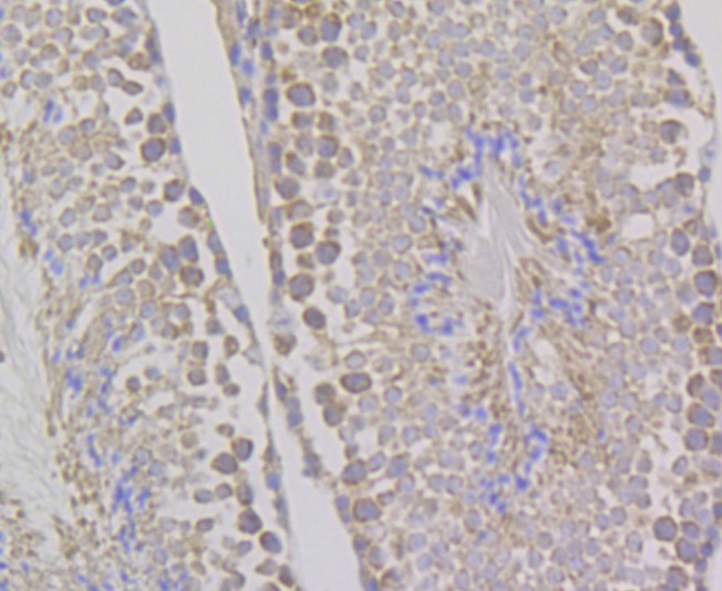 Anti-WNK1 Antibody (1S306)