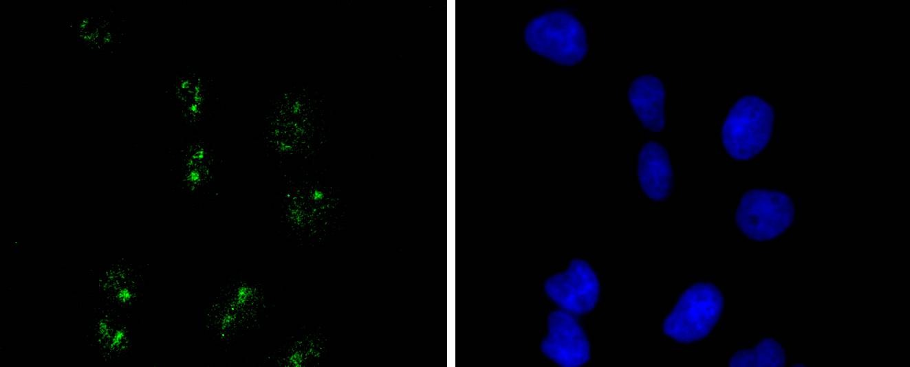 Anti-Wilms tumor/WT1 Antibody (8L145)
