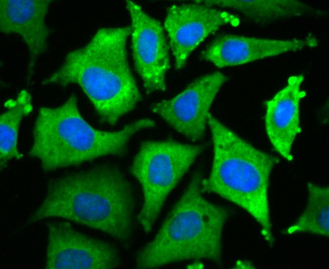 Anti-Wnt2b Antibody (5C251)