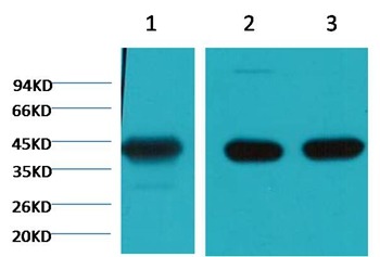 Anti-ACTA1 Antibody (8I400)
