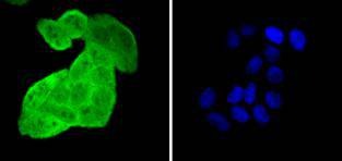 Anti-HSPA4 Antibody (7T809)