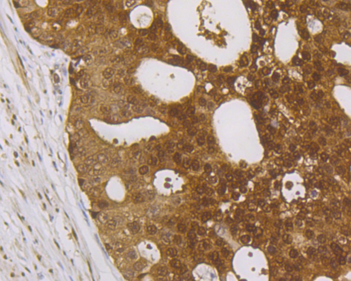 Anti-IRAK2 Antibody (9Y118)