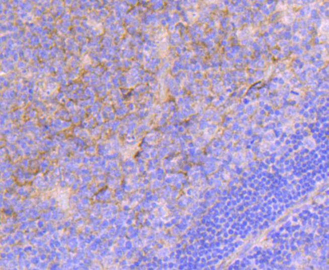 Anti-ITGA5 Antibody (5F909)