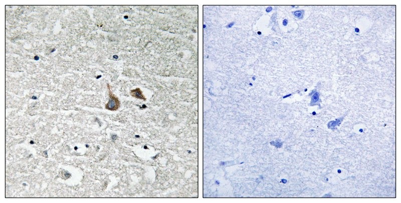 Anti-Phospho-IRAK1 (Ser376) Polyclonal Antibody