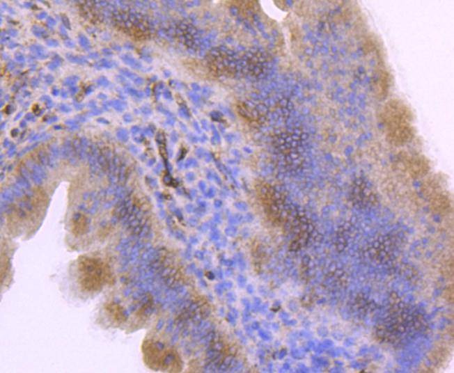 Anti-ITGA5 Antibody (5F909)
