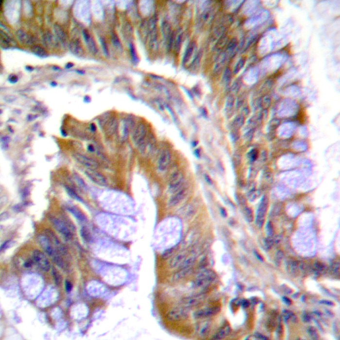 Anti-Phospho-IRAK1 (Thr100) Polyclonal Antibody