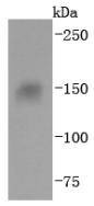 Anti-ITGA5 Antibody (5F909)