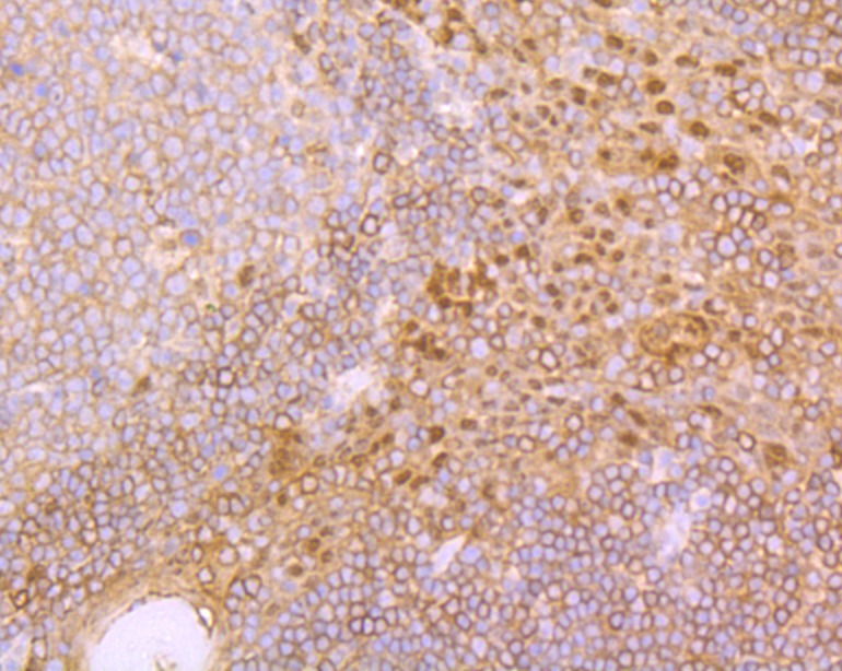 Anti-IRAK2 Antibody (9Y118)