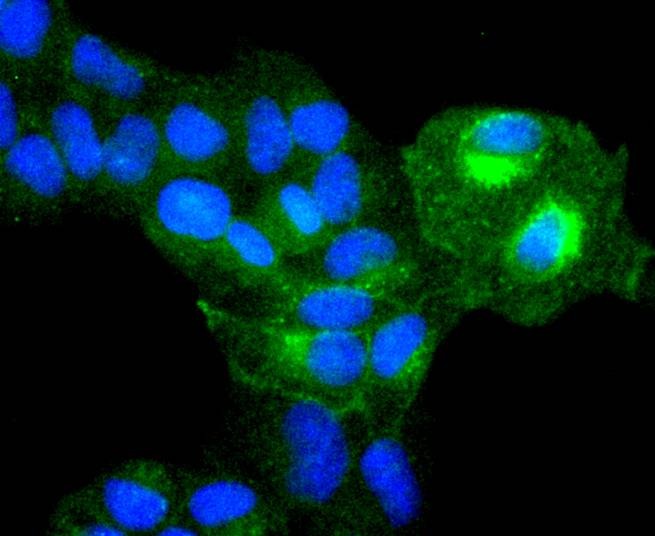 Anti-ITGA5 Antibody (5F909)