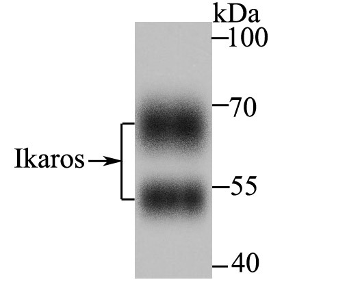 Anti-IKZF1 Antibody (8M494)