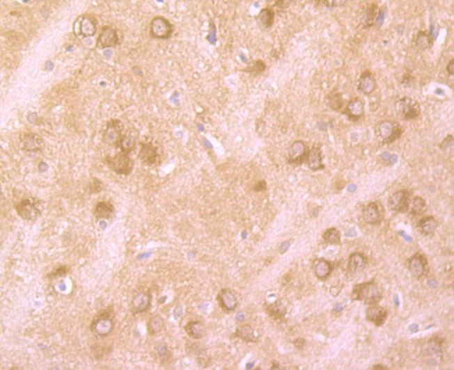 Anti-HTT Antibody (6D662)