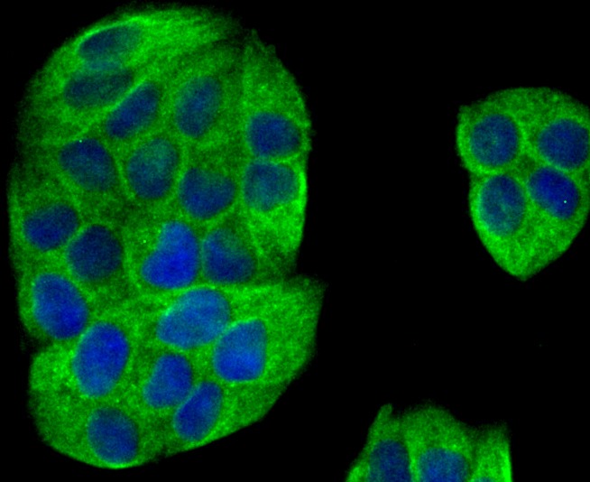 Anti-IQGAP1 Antibody (5T212)