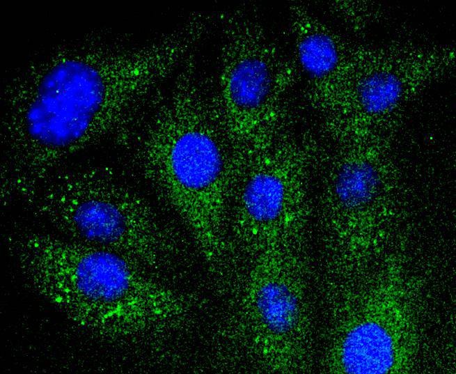 Anti-NFKBIA Antibody (1J77)