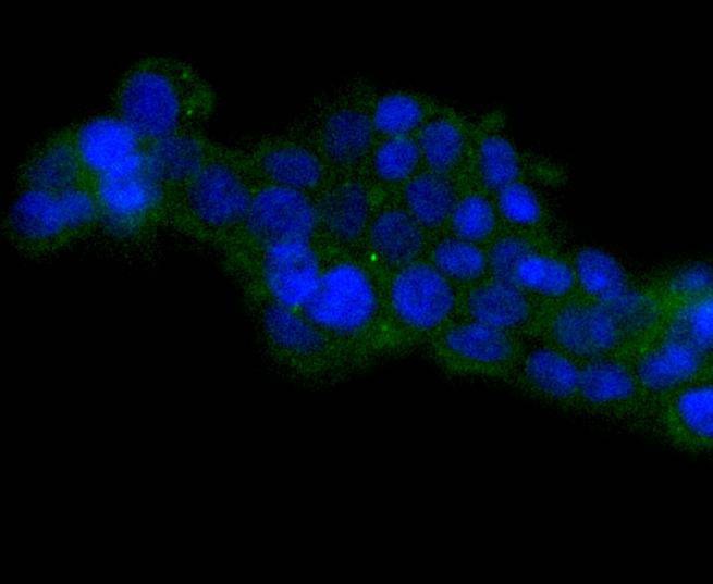 Anti-HSPA14 Antibody (8Q329)