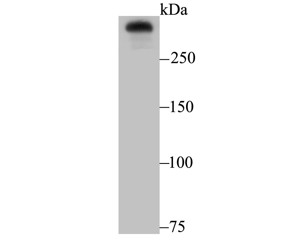 Anti-HTT Antibody (6D662)