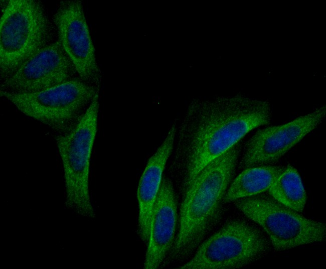 Anti-IQGAP1 Antibody (5T212)