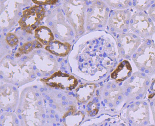 Anti-NFKBIA Antibody (1J77)